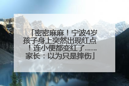 密密麻麻！宁波4岁孩子身上突然出现红点！连小便都变红了……家长：以为只是摔伤